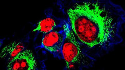 _94970505_idt-hela-cells-2.jpg