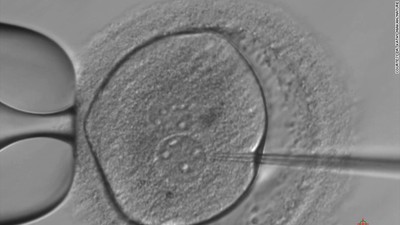 170921143455-01-uk-gene-editing-embryos-fertility-study-exlarge-169.jpg