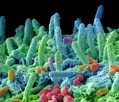 Science-Photo-Library-bacterias-microscopio-.jpg